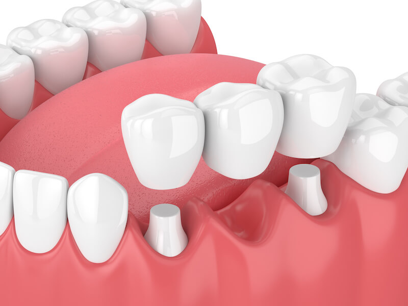 dr. lindsay cash at pearl dental studio