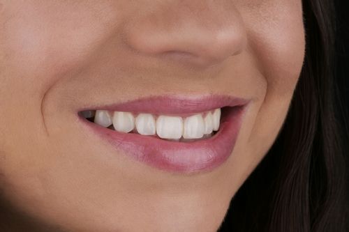 smiling lady after cosmetic dentistry treatments 