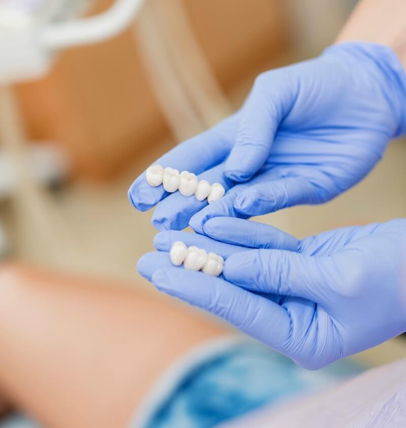 greenville dental crowns 