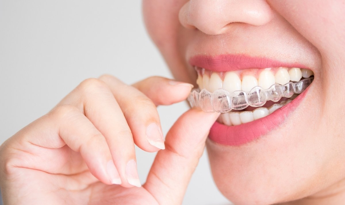 dr. lindsay cash at pearl dental studio