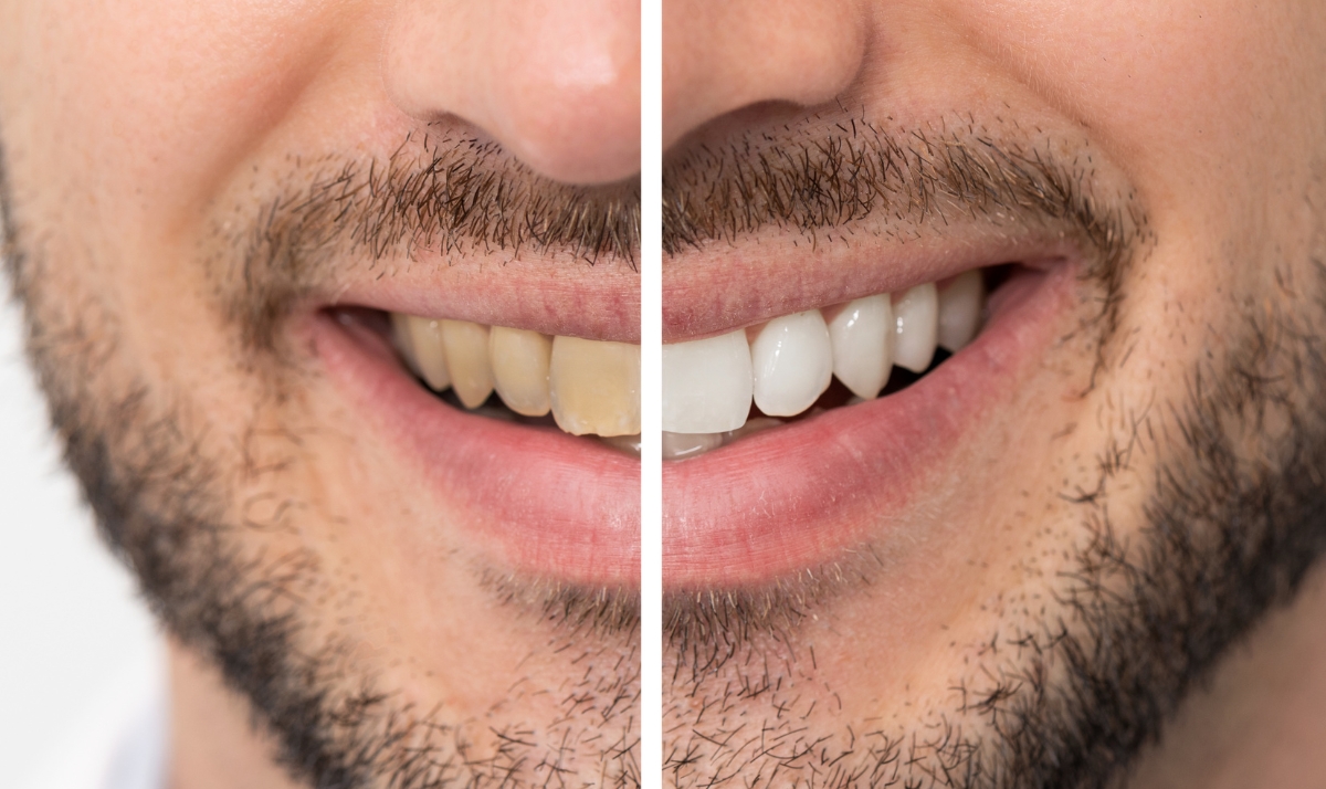 dr. lindsay cash at pearl dental studio