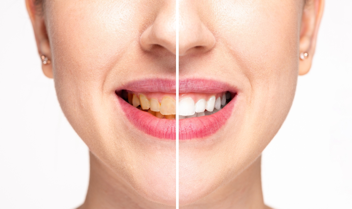 dr. lindsay cash at pearl dental studio