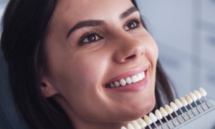 pearl dental creates natural-looking veneers