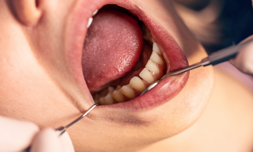 dentist near simpsonville for gum evaluation